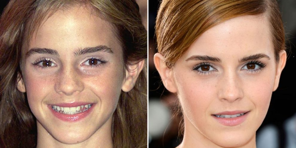 emma-watson-1-1024×768-1