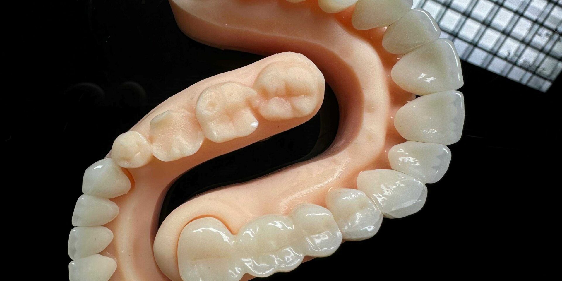 Schiefe Zähne überkronen Schiefe Zähne überkronen